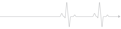 EKG