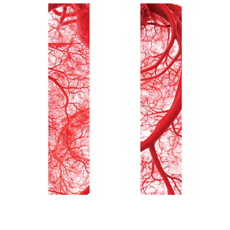 Microvascular Disease (MVD)